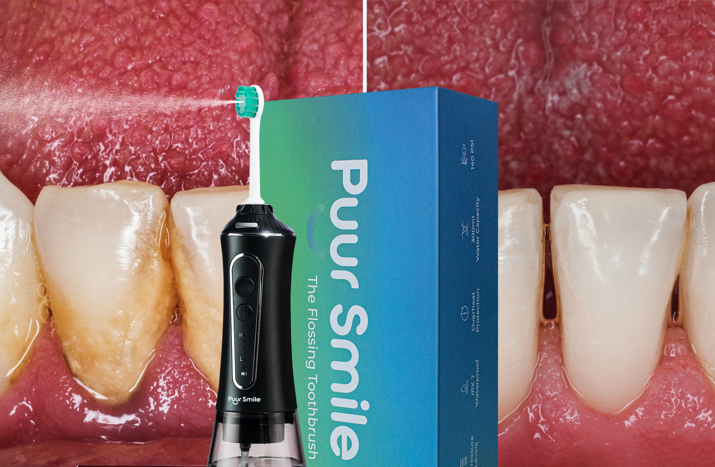 The 60-Second Solution That Stops Bad Breath, Bleeding Gums & Expensive Dental Bills